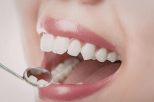 Soğuk ve sıcak uyaranlara karşı diş hassasiyeti yaşayan bireyde diş ve diş eti yapısının gösterimi