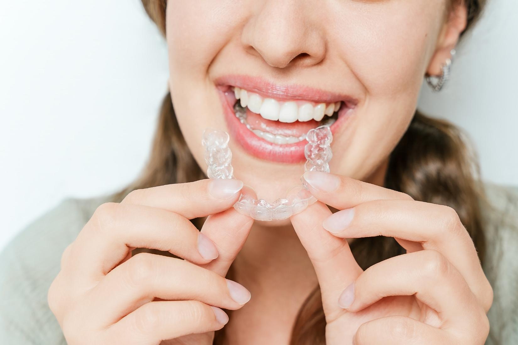 Şeffaf plak tedavisi ile diş dizilim bozukluklarının estetik ve kontrollü şekilde düzeltilmesini gösteren ortodontik uygulama