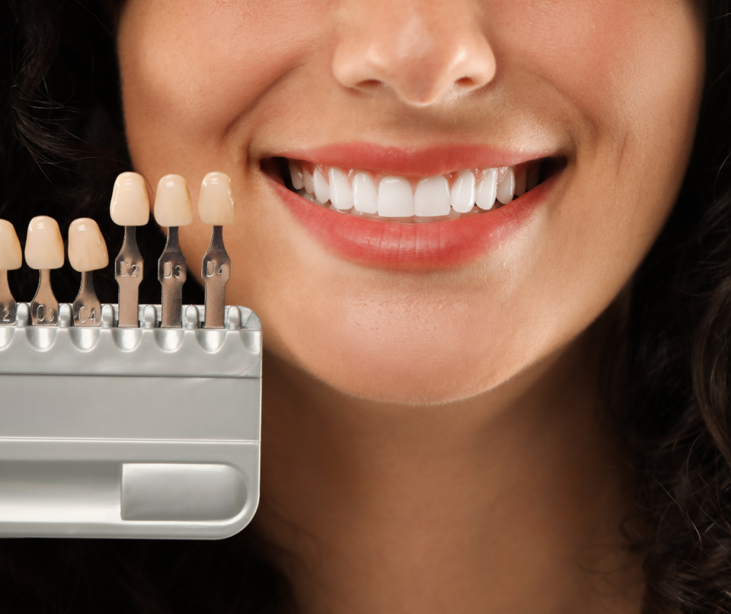 konya yaprak porselen uygulaması örnek ön diş estetiği