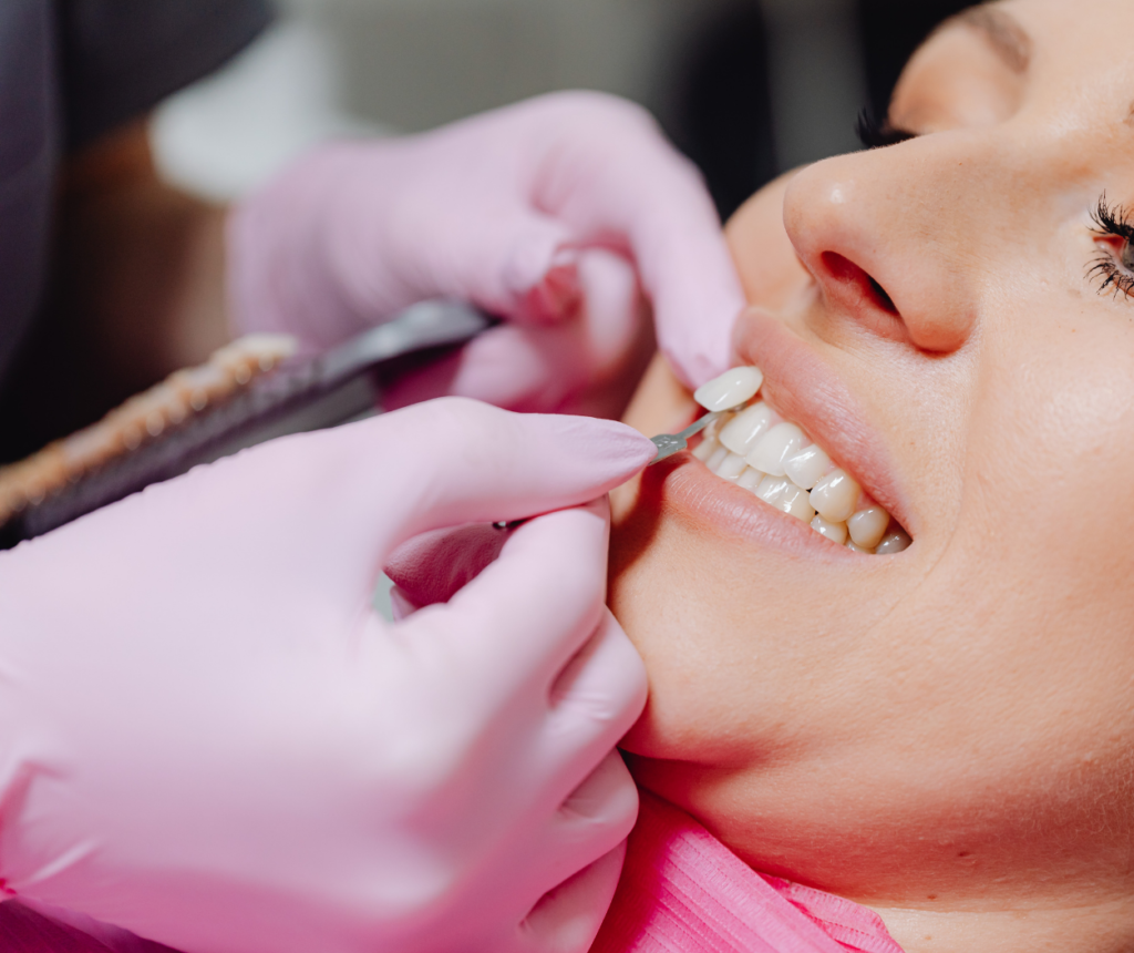 konya diş kaplama lamina porselen yakın plan görünüm