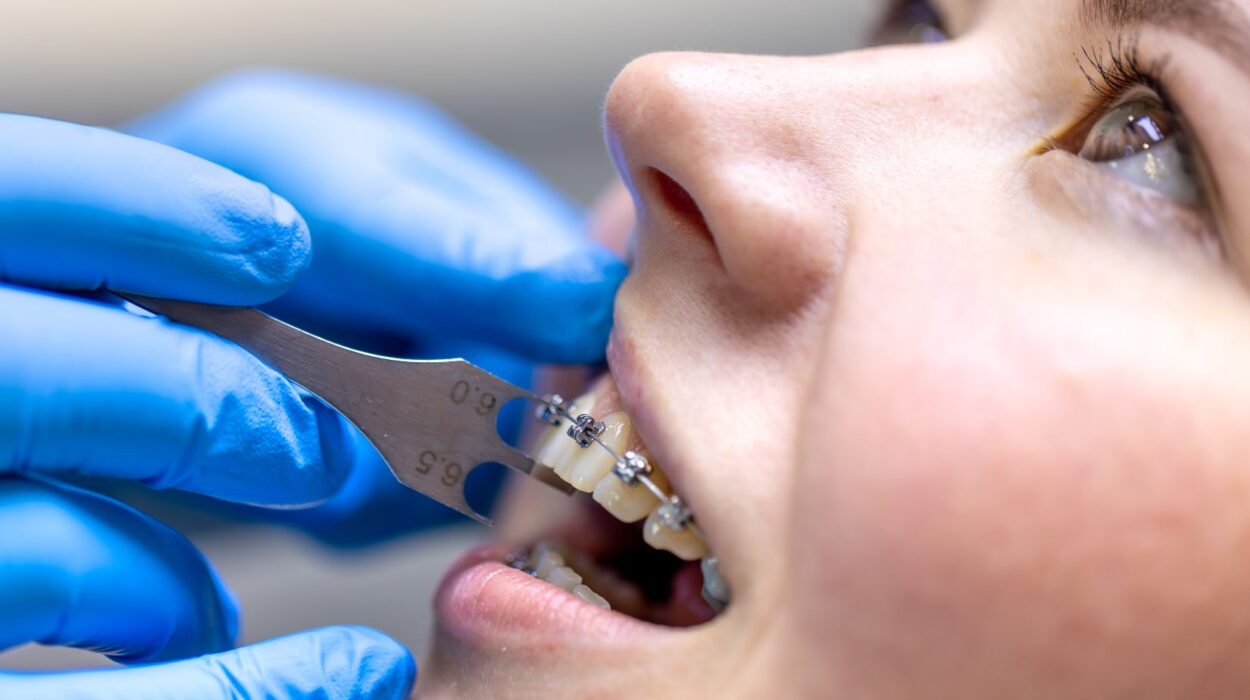 Ortodontik tedaviyle çene ilişkilerinin değerlendirilmesi ve büyüme döneminde yönlendirilmesini gösteren görsel