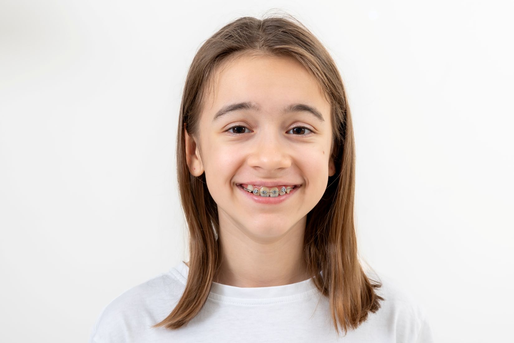 Çocuklarda çene gelişiminin ortodontik muayene ile değerlendirilmesini gösteren görsel