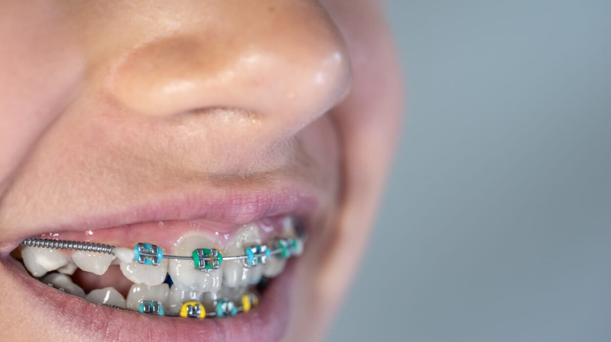 Çocuk, ergen ve yetişkinlerde ortodontik tedavi zamanlamasını gösteren diş gelişimi ve ortodonti görseli