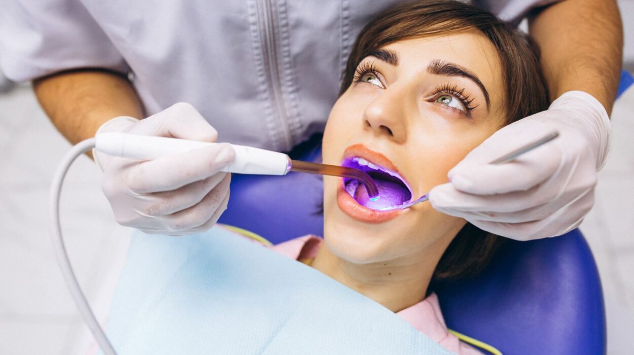 Devital bleaching uygulaması ile renk değişmiş kanal tedavili dişin içten beyazlatılmasını gösteren diş görseli
