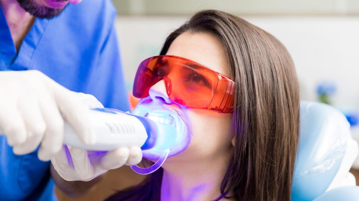 Diş beyazlatma uygulaması sırasında dişlere jel uygulanmasını gösteren estetik diş hekimliği görseli