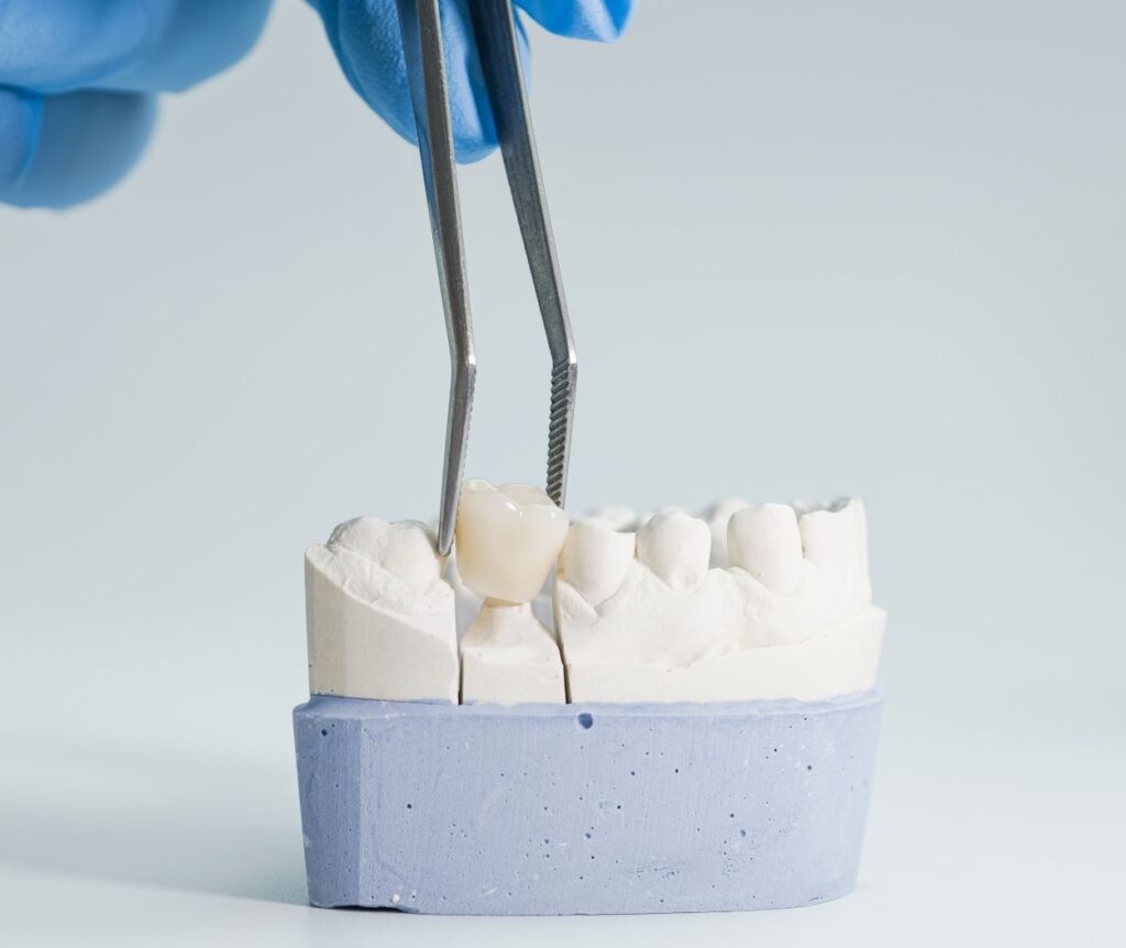 Konya porselen diş kaplama uygulaması öncesi dişlerin estetik değerlendirmesi