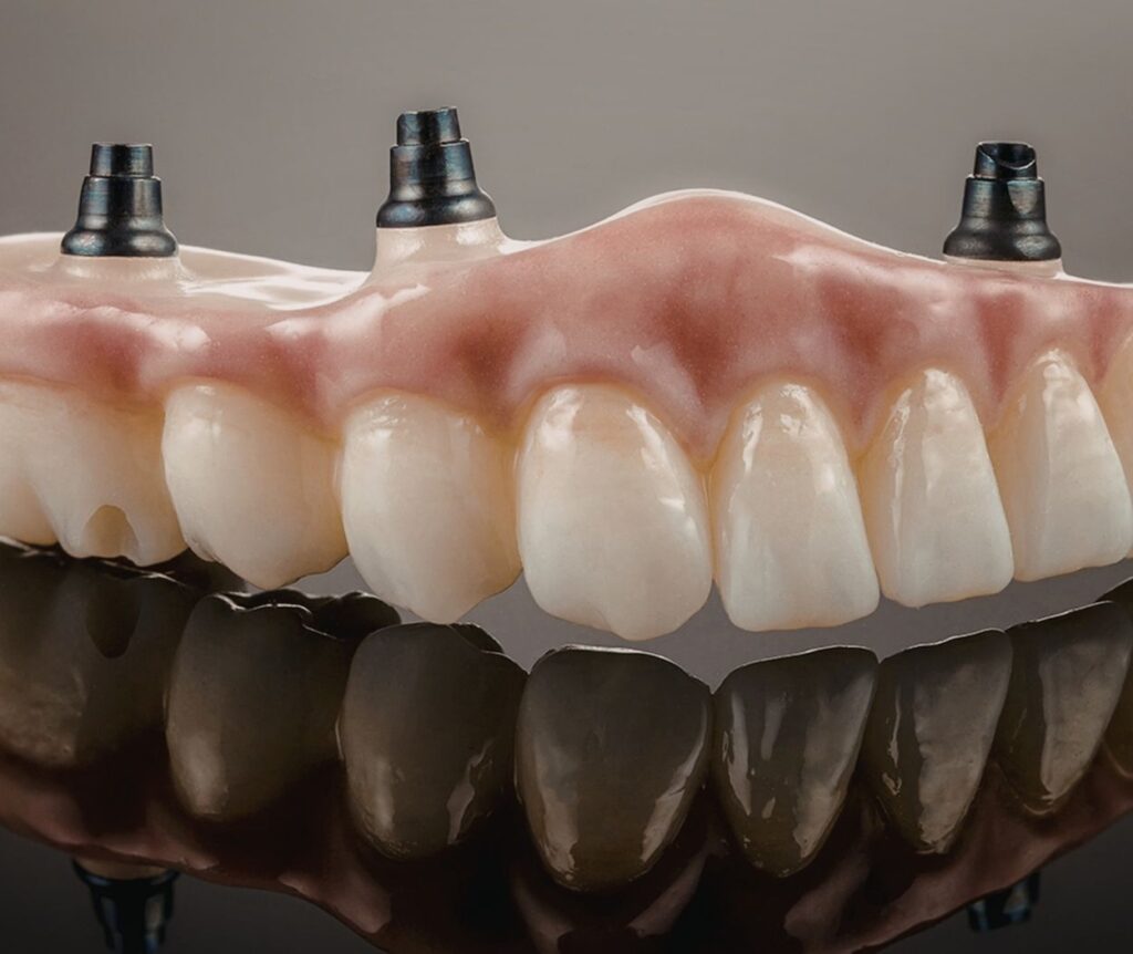 Konya implant üstü protez planlamasında sabit ve hareketli protetik üst yapı değerlendirmesi