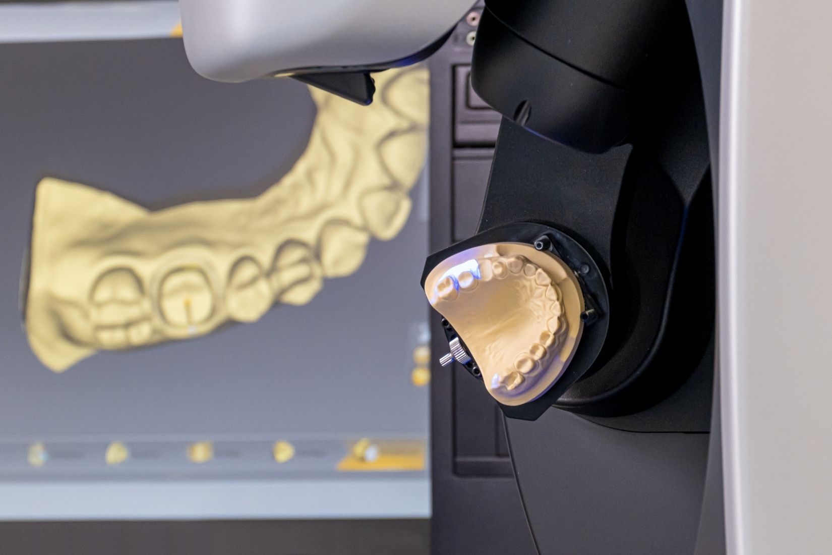 CAD/CAM diş hekimliğinde ağız içi tarama ve dijital restorasyon tasarımının gerçekleştirildiği klinik çalışma görüntüsü.