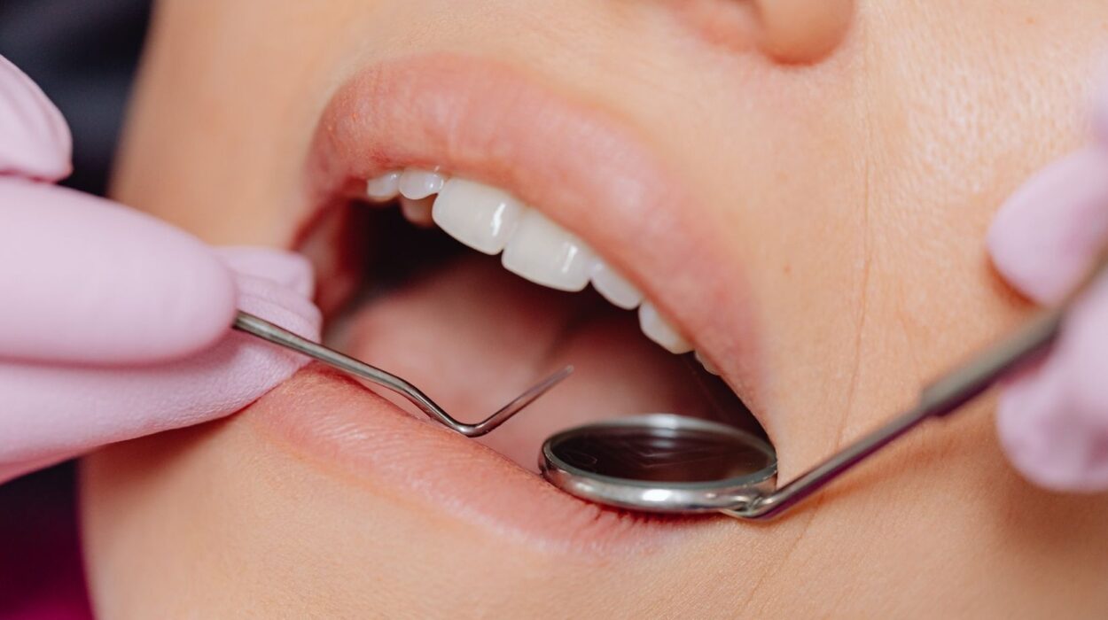 Kompozit bonding uygulanmış ön dişlerde renk uyumu ve yüzey parlaklığının klinik olarak değerlendirildiği ağız içi görüntü.